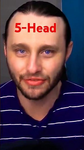 SSundee's Downfall, Divorce, and Hairline Surgery #roast #funny #brainrot #tiktok #memes #videoessay