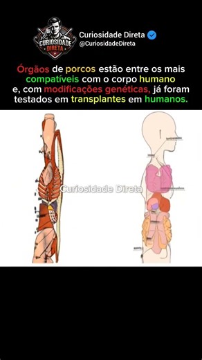 Os órgãos mais compatíveis com o corpo humano não são humanos