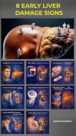 🚨 8 Early Liver Damage Signs