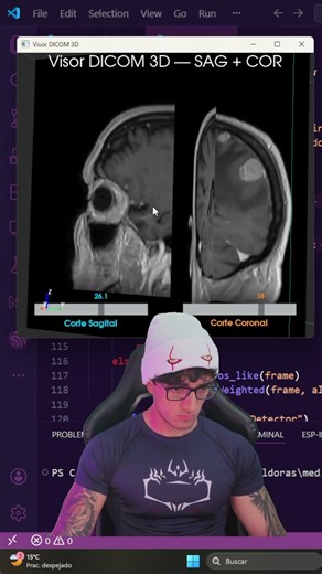 Pydicom example. #programacion #pydicom #python