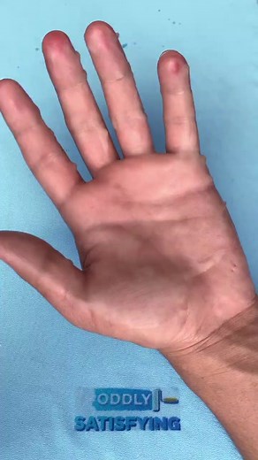Peeling Hand Skin #oddlysatisfying #satisfying #fyp | satisfying