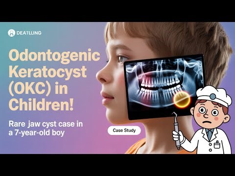 Odontogenic Keratocyst (OKC) in a 7-Year-Old | Rare Pediatric Jaw Cyst Case & Treatment