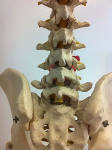 Lumbar anterior root stimulator - Alchetron, the free social encyclopedia