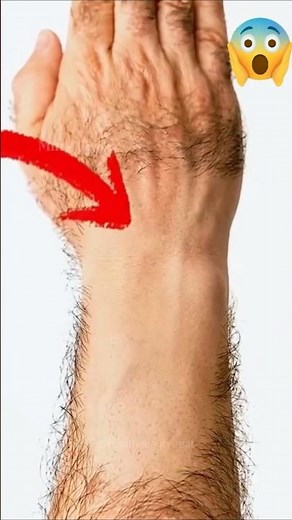 Remove Unwanted Facial Hair Naturally At Home | Best Hair Removal Remedy #facialhair #unwantedhair