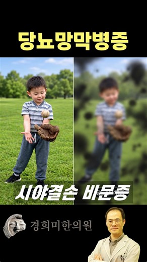 당뇨망막병증 증상 치료
