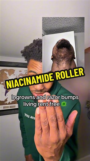 Effective Ingrown Hair Treatment for Smooth Skin