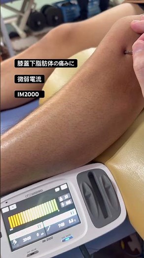 Microcurrent therapy (IM2000) for infrapatellar fat pad inflammation