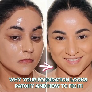 Why Your Foundation Looks Patchy | Smitha Deepak