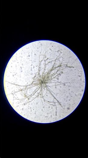 I Sealed This Jar for 14 Days… Look What Grew 😳 #microscopy #microbialgrowth #biologyexperiment