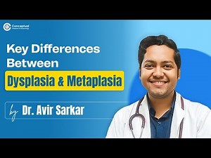 Key Differences Between Dysplasia and Metaplasia by Dr. Avir Sarkar