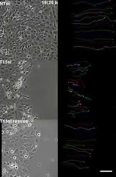 Time-lapse imaging of wound healing assay in TRIM15-depleted cells