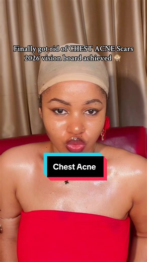 Effective Strategies to Clear Chest Acne and Scars