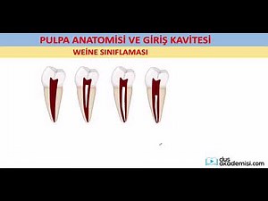 dusakademisi.com ENDODONTİ Paketi PULPA ANATOMİSİ, KAVİTE ve DENTAL ANOMALİLER Konu Anlatımı