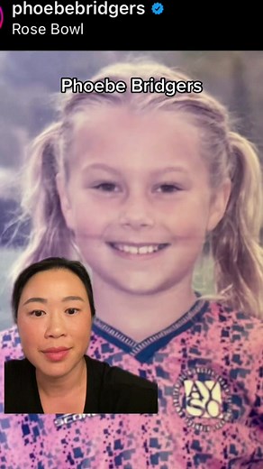 Phoebe Bridgers: Veneers and Smile Transformations Explained