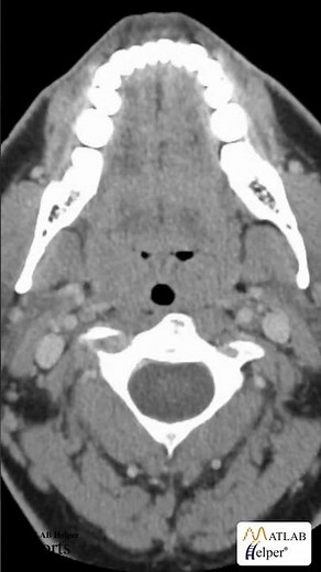 MATLAB in the Medical Industry #Shorts