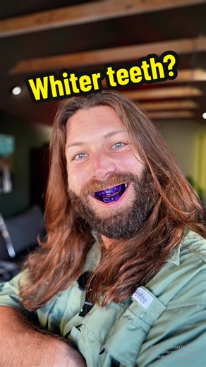 Achieve Whiter Teeth with Dr. Dent Whitening Strips