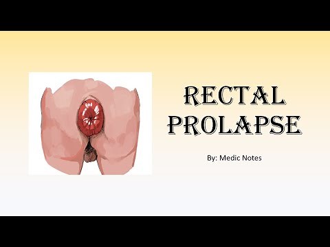Rectal prolapse - risk factors, signs and symptoms, investigation, treatment, types of surgeries