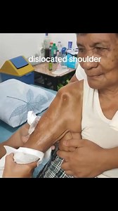 Dislocated shoulder placed back into place 🤯 Please note: This is not intended as medical advice, diagnosis or treatment. Always check with a health care professional. . . . 👉Follow NEW page Health 4 all for more medicine and nutrition posts👈 . ❤️ LIKE 💬 COMMENT 👥 SHARE 💾 SAVE . For non-profit educational purposes only . #drmuhammedziya #suture #pain #skin #skincare #technique #technology #allfollowersfriends #allfollowers #viral #reel #viewers #reelsfacebook #reel #シ #reelsvideoシ #discove