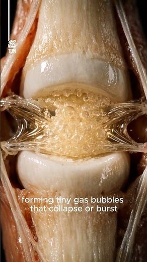 What Causes Finger Cracking?