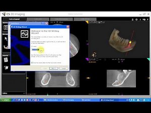 Tutorial CS 3D imaging software. 17-Carestream. Exportar - Grabar el volumen.avi