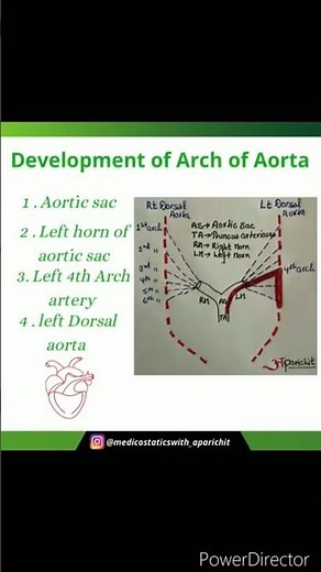 Development Of Arch of Aorta | Embryology |Anatomy | Heart | MBBS 1st year
