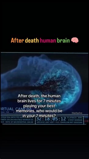 Ttechsolve on Instagram: "Here is the truth 👇 Scientists have observed brief bursts of brain activity moments after death, sometimes resembling memory or dream states. This led to the idea of a "life replay," but the famous "7 minutes" claim is myth. Evidence shows variability, not certainty, and no proof that everyone experiences such a replay. 🎥 credit: @tenzwritess ⚠️We do not own this content. All credit goes to the respective owners. No copyright infringement intended for educational use 