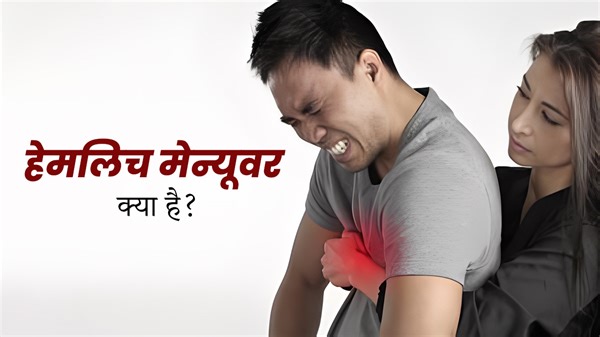 Heimlich Maneuver क्या है? दम घुटने पर जान बचाने में करता है मदद