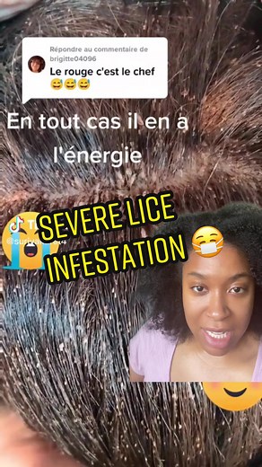 Understanding Severe Lice Infestation and Treatment Options