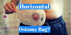 Wearing Your Ostomy Bag Horizontally: FAQ (w/ video) | VeganOstomy