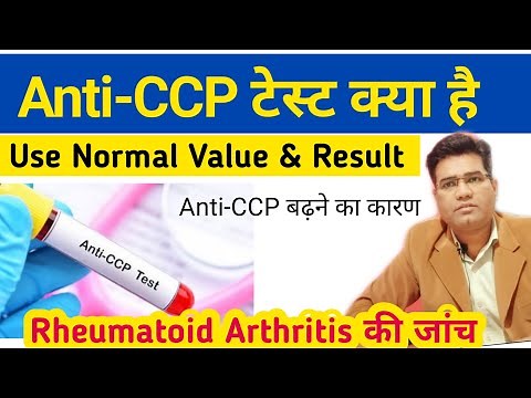What is Anti-CCP Test Use Indications Normal Value | Anti Cyclic Citrullinated Peptide test
