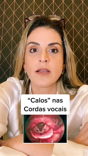 Calos nas Cordas Vocais: Tratamento Eficaz