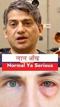Red eye is common… but sometimes, it can be a warning/ Dr. Pawan Gupta