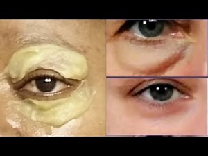 APPLY ONCE A DAY REMOVE EYE BAG AND PUFFY EYE