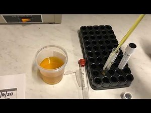 Urinalysis