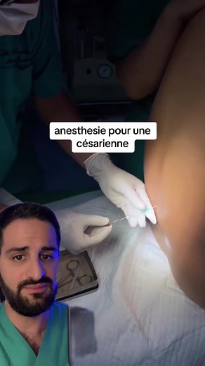 C'est la méthode de choix lors d'une césarienne programmée. C'est aussi utiliser pour toutes les interventions sur le bas du corps . C'est globalement moins lourd qu'une anesthésie générale sur le plan cardiaque et respiratoire , mais tout aussi efficace . #medecine #pourtoi #medical #soignant #chirurgie #anesthesie #peridurale #rachianesthesie #iade #cesarienne #grossesse #maman #grossesse2022 #grossesse2023 #apprendresurtiktok #enfant #accouchement2023 #accouchement2022