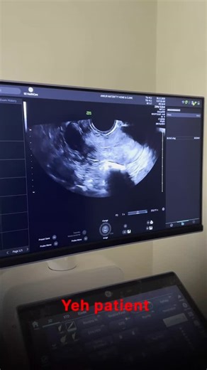 Dr. Mohil Patel on Instagram: "Understanding your ovulation cycle is one of the most important steps when planning a pregnancy. With today’s advanced technology, a 3D pelvic scan can give a far more accurate picture of your reproductive health — helping you track ovulation, assess egg release, and improve conception outcomes. In this video, Dr. Mohil Patel explains: ✔️ What ovulation tracking means ✔️ How a 3D scan helps in fertility planning ✔️ When to get a 3D scan ✔️ Benefits over traditional
