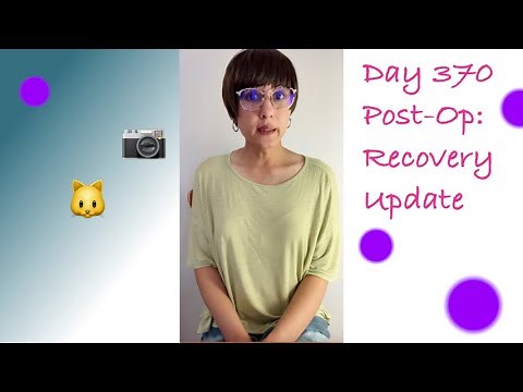 SRS 370 Days Post-Op: Recovery Update, Vagiversary | M62E01 🦋 Henna’s Channel