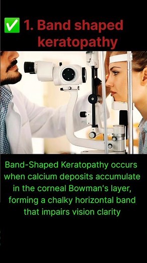 Band-Shaped Keratopathy (BSK) — Calcium Deposition in Cornea | Causes, Symptoms & Treatment #eyes