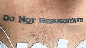 ‘Do Not Resuscitate’ tattoo: Hospital staff grapple with ethical dilemma
