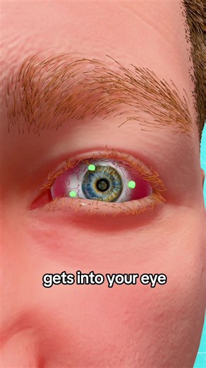 Do this if you got something in your eye 👀 | eye cleaning