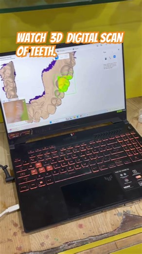 3d dental teeth scan #3d #3dscan #dentalscanner