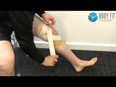 Self Taping Technique - Medial Collateral Ligament (MCL)