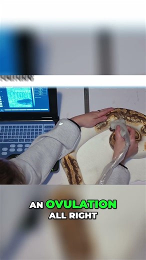 Unlock Ovulation Secrets Follicle Size & Bladder Landmarks Revealed!