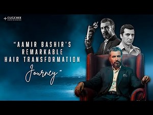 Celebrity Hair Transplant: Aamir Bashir Trust Eugenix for his Hair Restoration