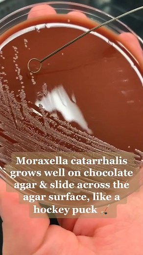 105K views · 1K reactions | Bacterial identification  #lablife #microbiology | Lab life | Facebook