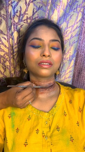 Hair India on Instagram: "Holi sfx acciident 🎨 #sfxmakeup #makeuptutorial #sfxmakeuptutorial #makeuptutorial #sfxmakeup #sfxmakeuptutorial #siliconeprosthetic #prosthetics ) #prostheticmakeup tmufx #makeupfx tfx #sfx #sfxmakeup #specialfx #makeup #casualty #bts #behindthescenes #prostheticapplication #filmmakeup #tvmakeup #hairindia=#explorepage #accident Disclaimer___I want to inform you instagram team. that I have not violated the Partner Monetization Policy/Content Monetization Policy/Commun