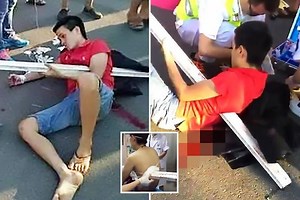 Moped rider impaled by huge pole just inches from his heart after horror crash... but somehow SURVIVES