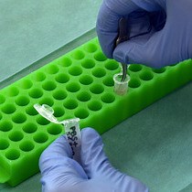 비디오: 라미네이팅 기술을 사용하여 인간 공막의 컨포칼 현미경 검사 수행