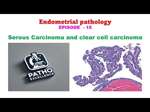 Endometrial Pathology | Episode 15 | Serous Carcinoma & Clear Cell Carcinoma | MBBS Pathology
