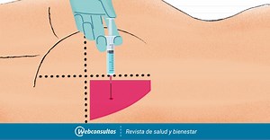Cómo poner una inyección intramuscular (y dónde) paso a paso